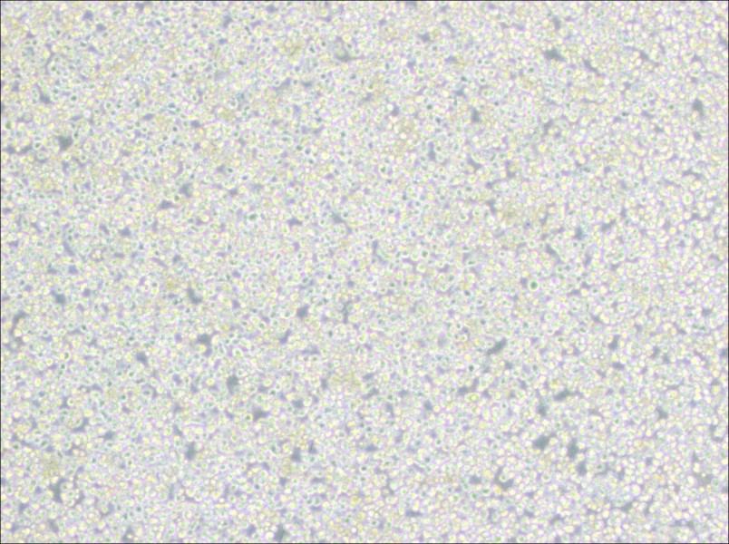 PC 61 5.3 [PC 61; PC 61.5.3] Cell Complete Medium-searchlist-1