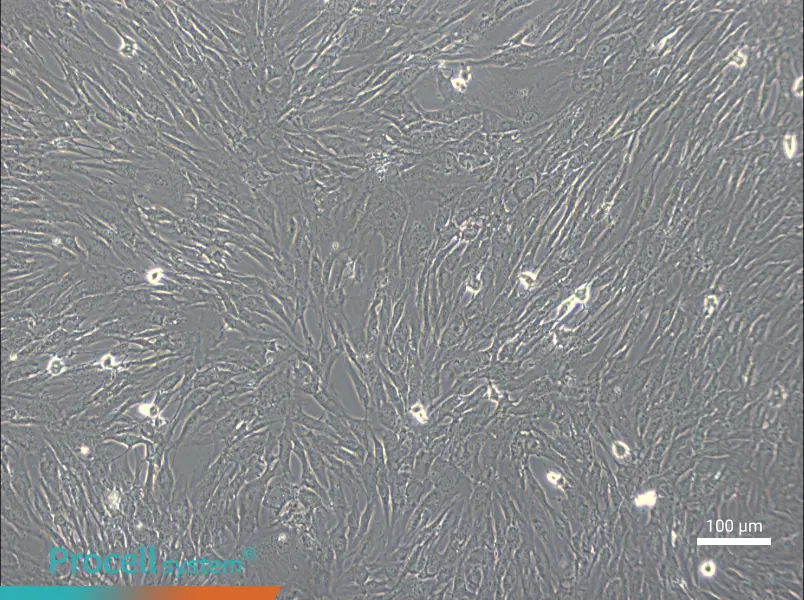 hTERT-HPNE - 1