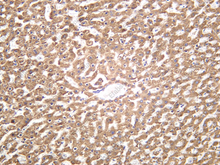 Recombinant MBL2 Monoclonal Antibody - 4