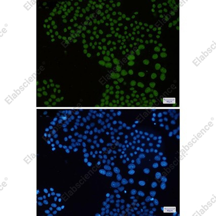 Recombinant Macro H2A.1 Monoclonal Antibody - 2