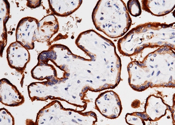 Recombinant Transferrin Receptor/TFRC/CD71 Monoclonal Antibody-searchlist-1