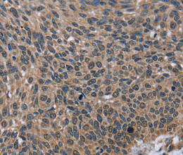 IMPDH2 Polyclonal Antibody - 2
