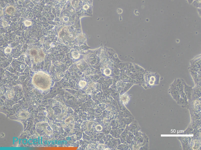 HCC1419 Cell Complete MediumHCC1419 Cell Complete Medium - 4