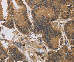 KCNG4 Polyclonal Antibody - 2