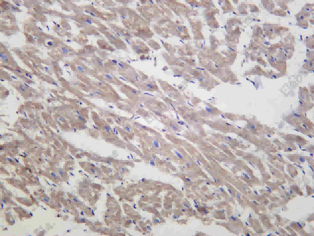 Recombinant TOMM70 Monoclonal Antibody - 1