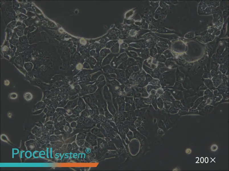 OE33 Cell Complete Medium - 6
