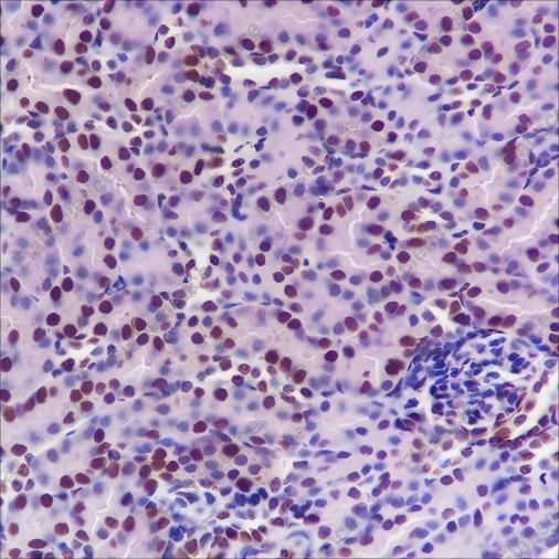 Recombinant SOD1 Monoclonal Antibody - 3