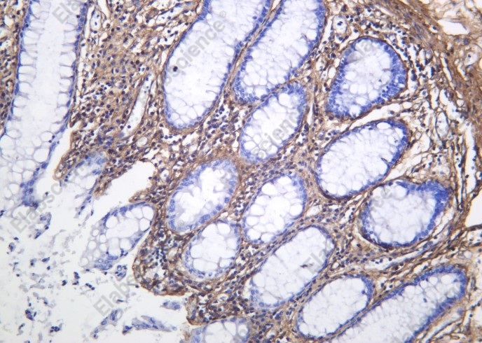 Recombinant Collagen VI Monoclonal Antibody - 1