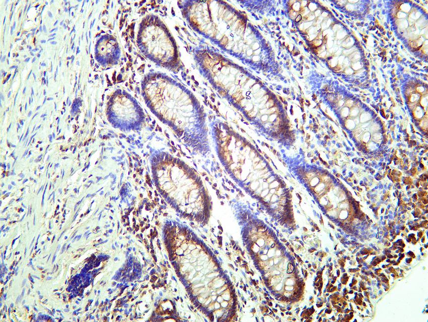 Recombinant SQSTM1/p62 Monoclonal Antibody - small - 6