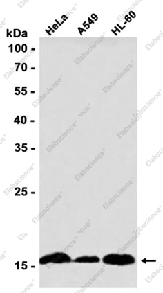 Recombinant SUMO Conjugating Enzyme UBC9 Monoclonal Antibody - 1