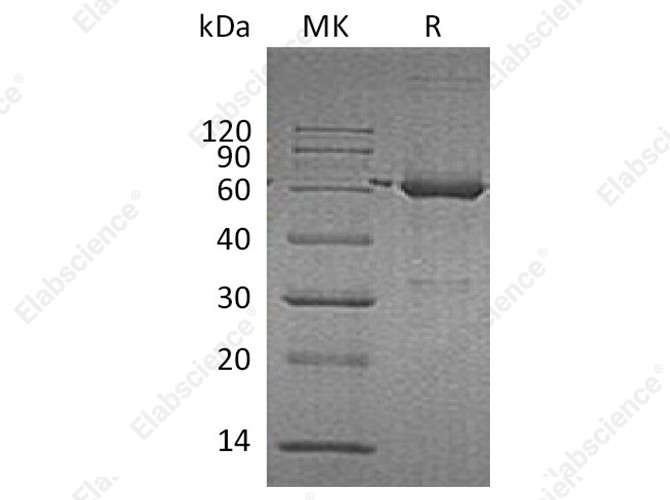 Recombinant Human Catalase/CAT Protein - 1