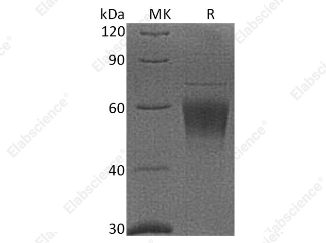 Recombinant Cynomolgus CRTAM/CD355 Protein (His Tag) - 1