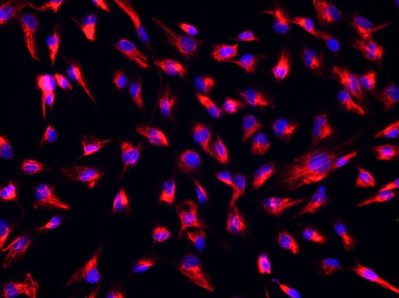 Rat Cardiac Fibroblast Complete Medium - 2