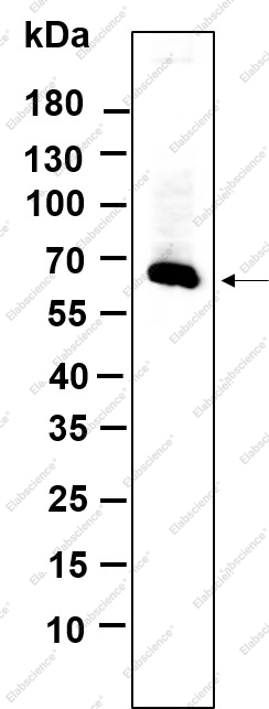 Recombinant MMP2 Monoclonal Antibody - 1