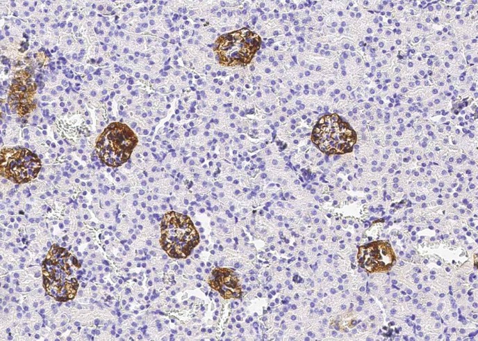 Recombinant Podoplanin/PDPN Monoclonal Antibody-searchlist-1