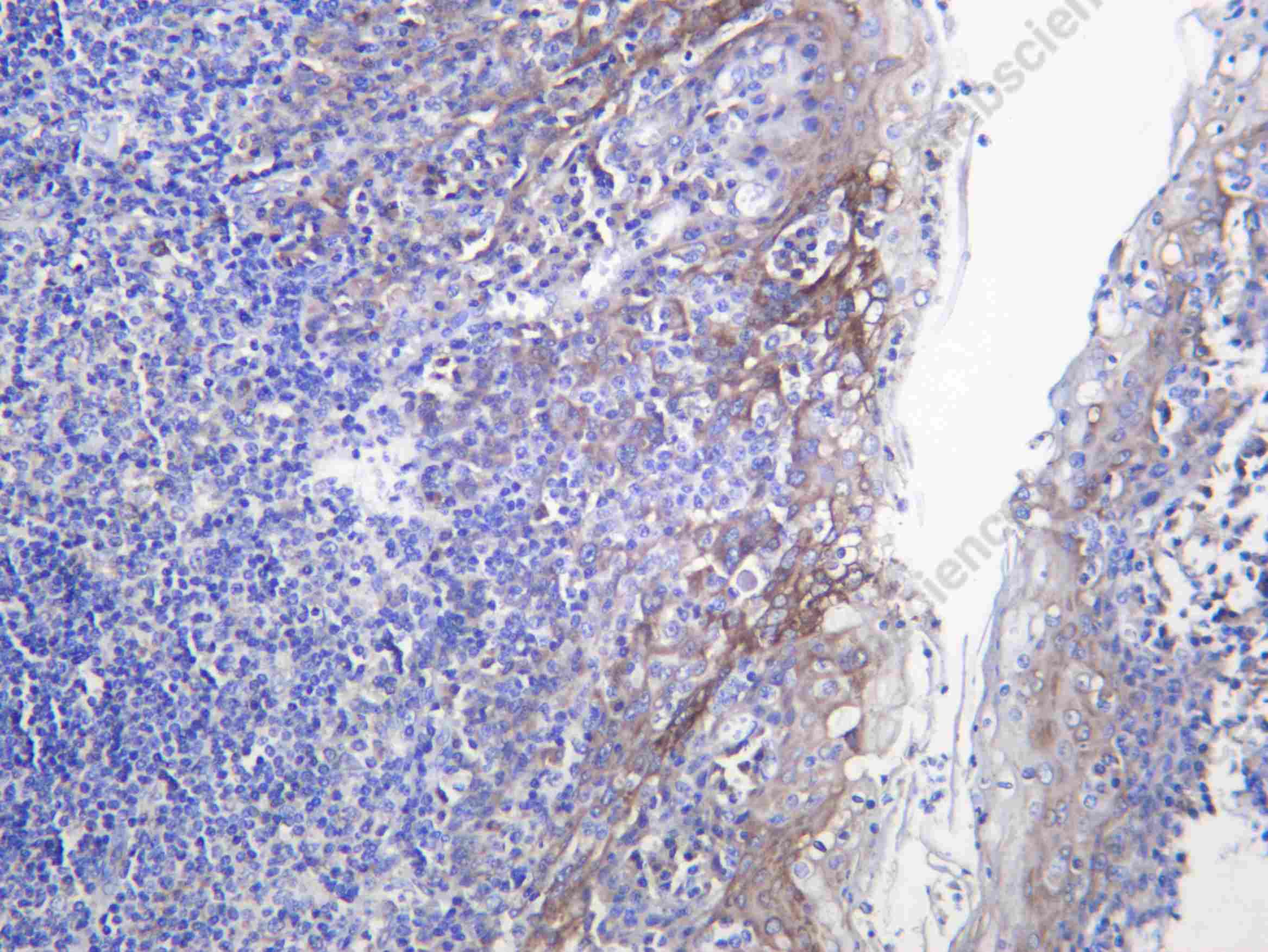 Recombinant SQLE Monoclonal Antibody - 1