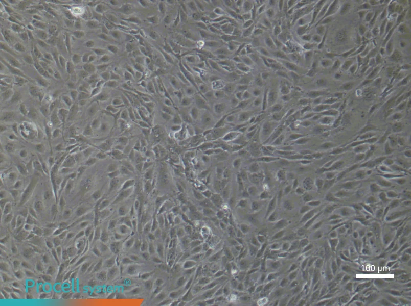 Human Pulmonary Microvascular Endothelial (Primary cell immortalization) Cell Complete MediumHuman Pulmonary Microvascular Endothelial (Primary cell immortalization) Cell Complete Medium - 1