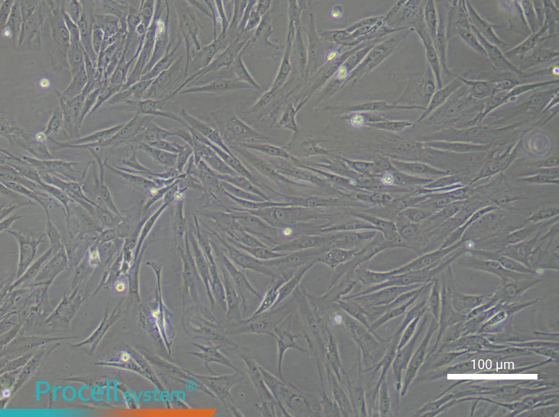 Human Oral Mucosal Fibroblast Complete Medium - 3
