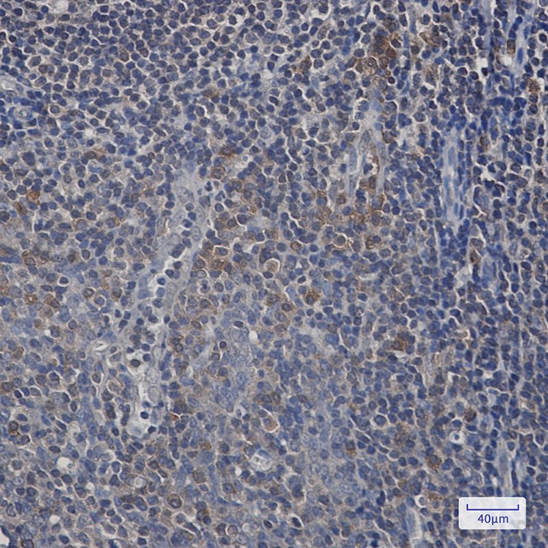 Recombinant UFC1 Monoclonal Antibody - 2
