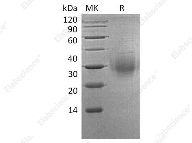 Recombinant Human BTLA/CD272 Protein (His Tag) - 1