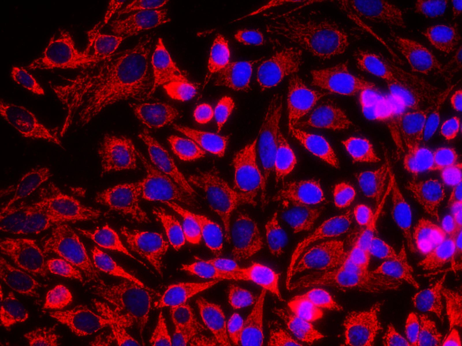 HSP-60 Polyclonal Antibody - small - 6