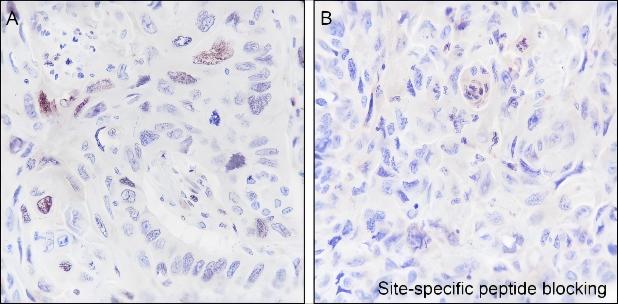 Recombinant Histone H2B (Ubiquityl Lys120) Monoclonal Antibody - 3