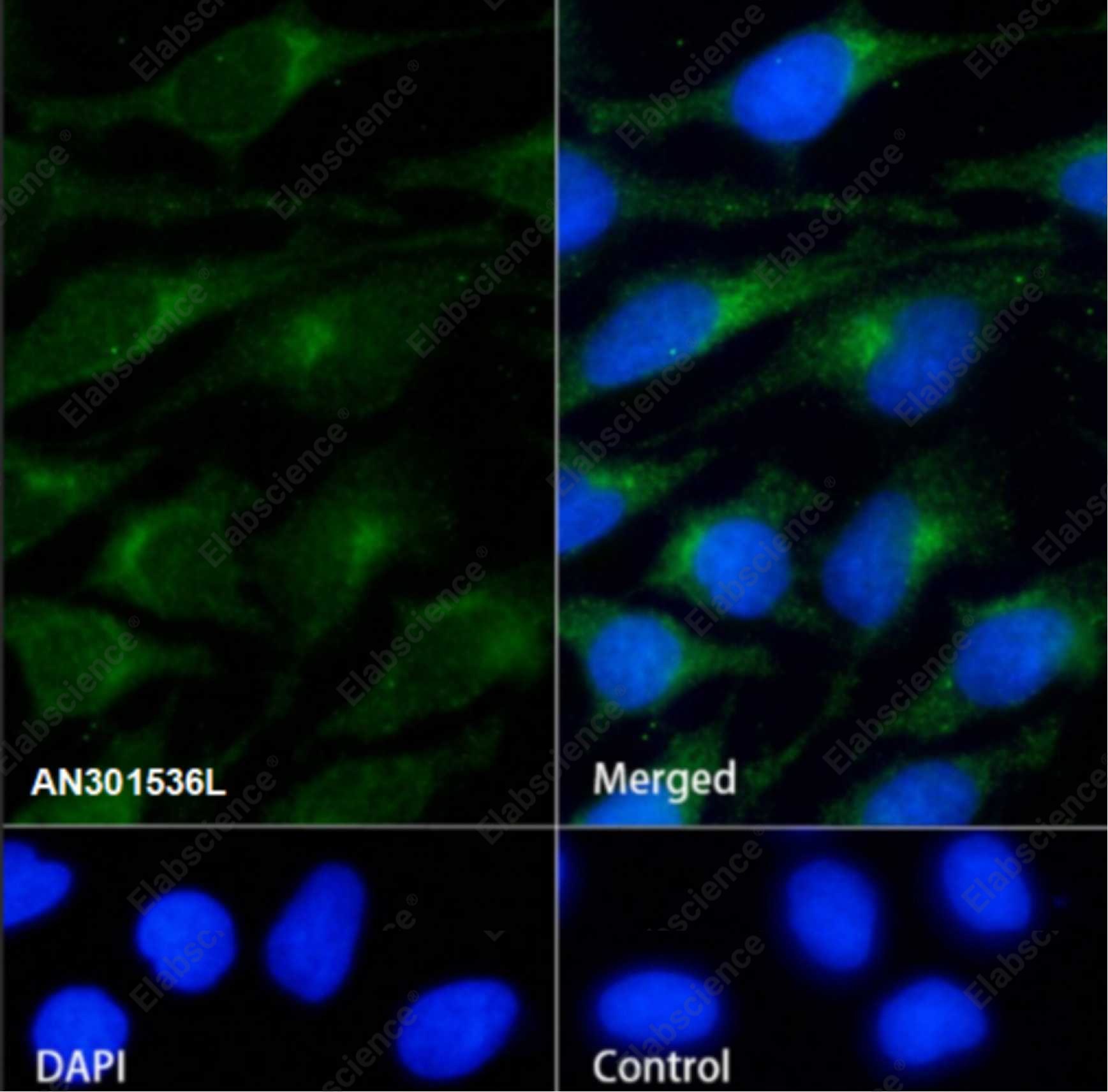 Recombinant GOSR1/GS28 Monoclonal Antibody - 2