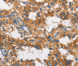 CLTC Polyclonal Antibody - 2