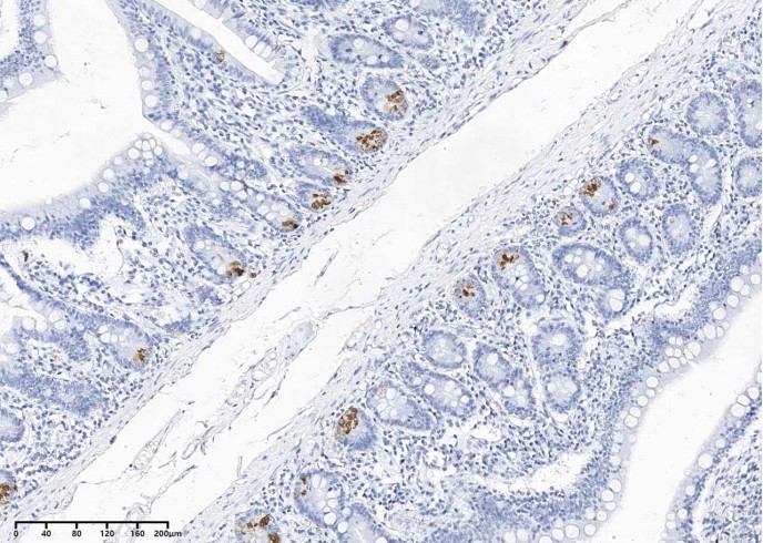 LYZ Monoclonal Antibody - small - 2