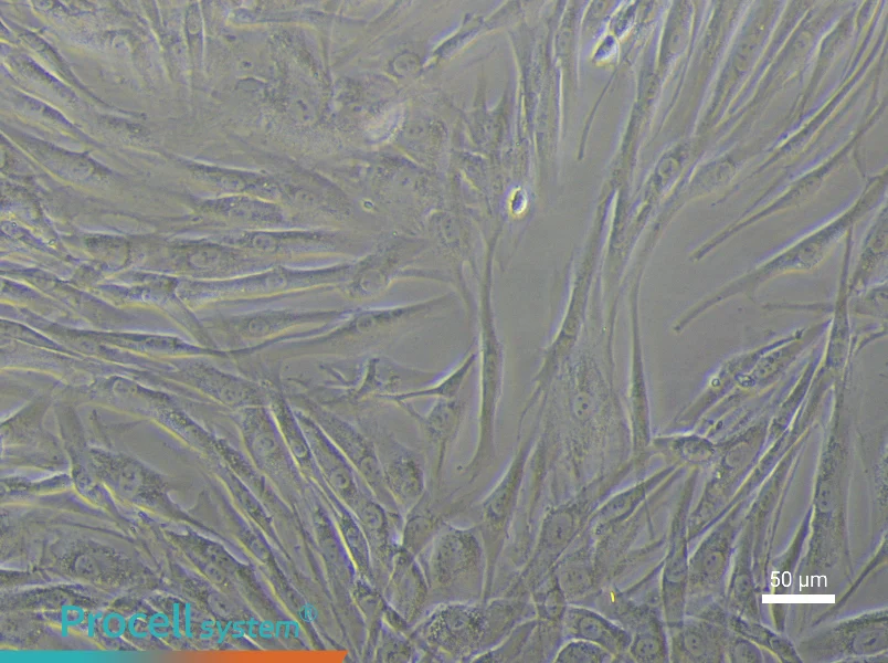 Human Uterine Fibroids Tissue-Derived Cell Complete Medium - 6