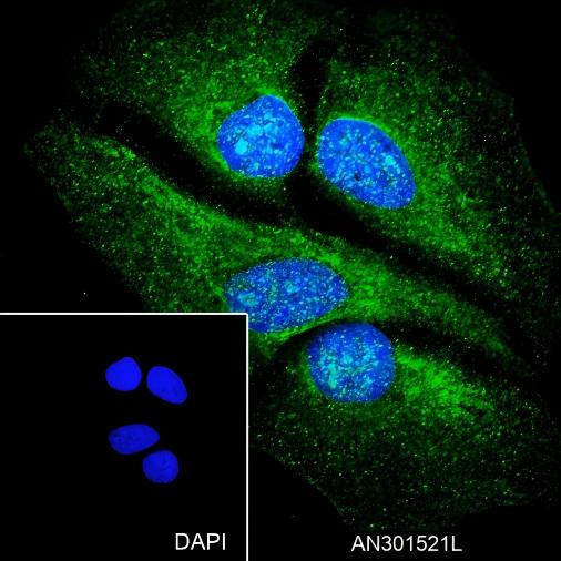 Recombinant FBXW7 Monoclonal Antibody - 3
