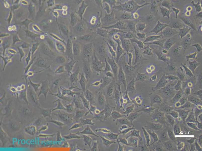 Mouse Aortic Endothelial Cells (Primary cell immortalization)Mouse Aortic Endothelial Cells (Primary cell immortalization) - 4