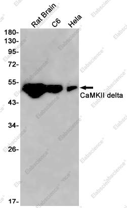 Recombinant CaMKII delta Monoclonal Antibody - 1