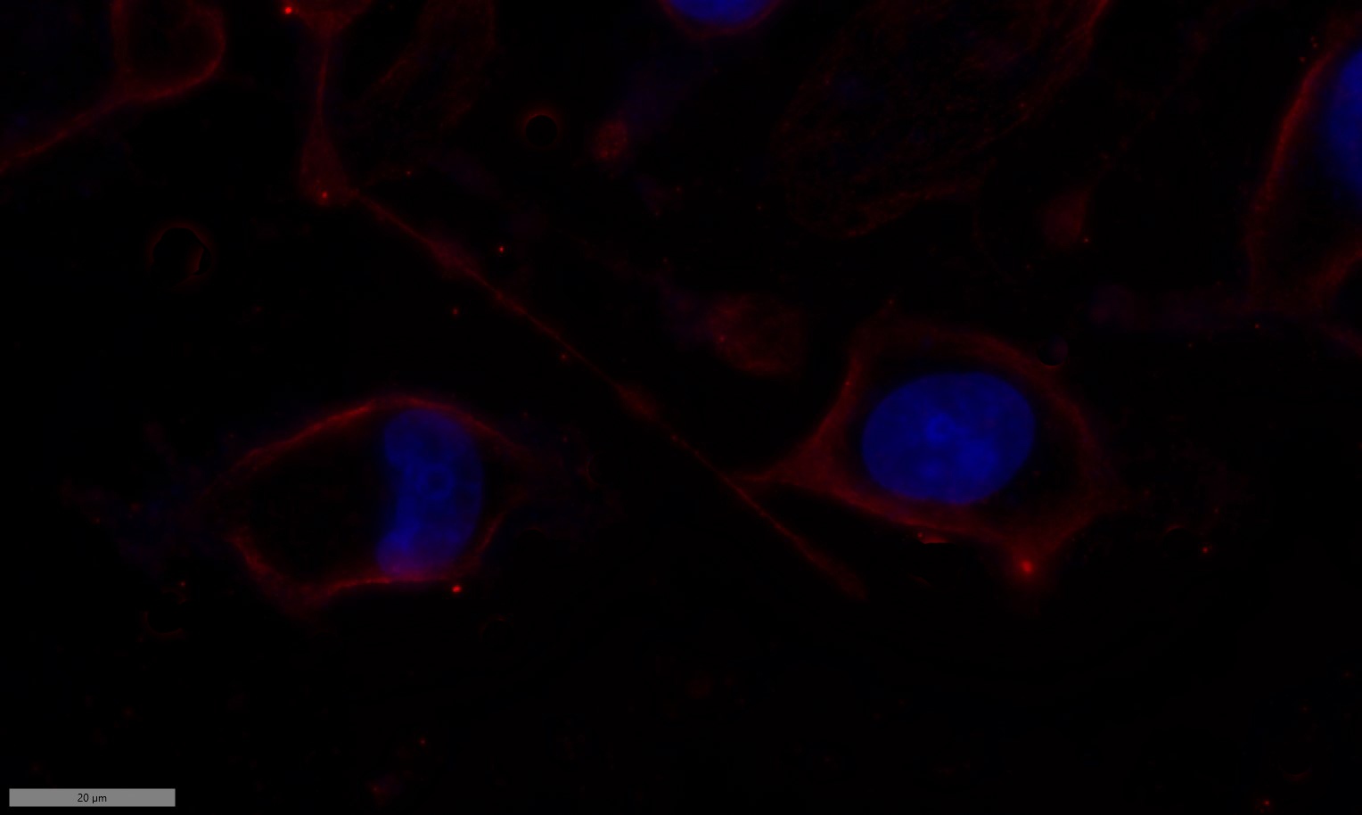 Recombinant PI3-Kinase p85 α Monoclonal Antibody - small - 7