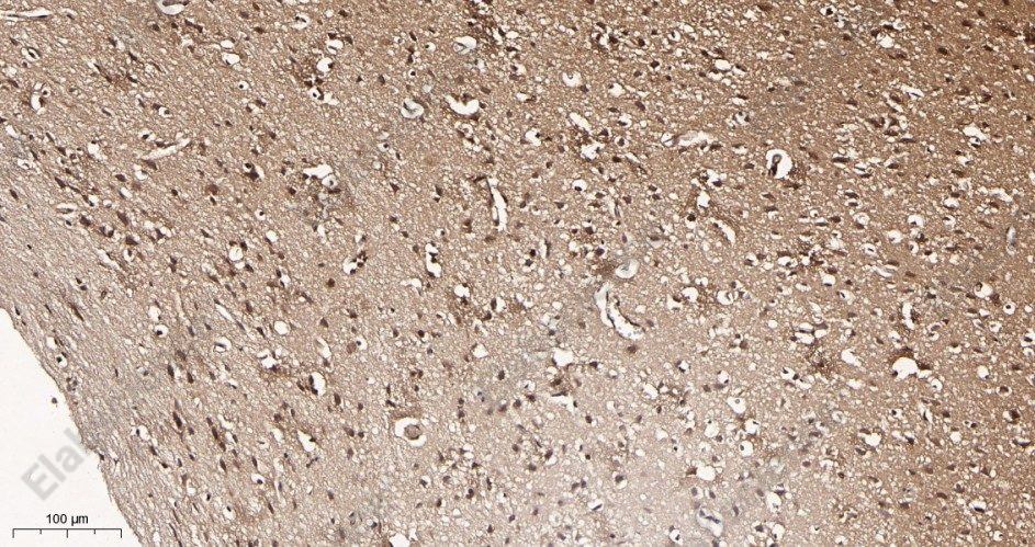 Recombinant TLS/FUS Monoclonal Antibody - 3