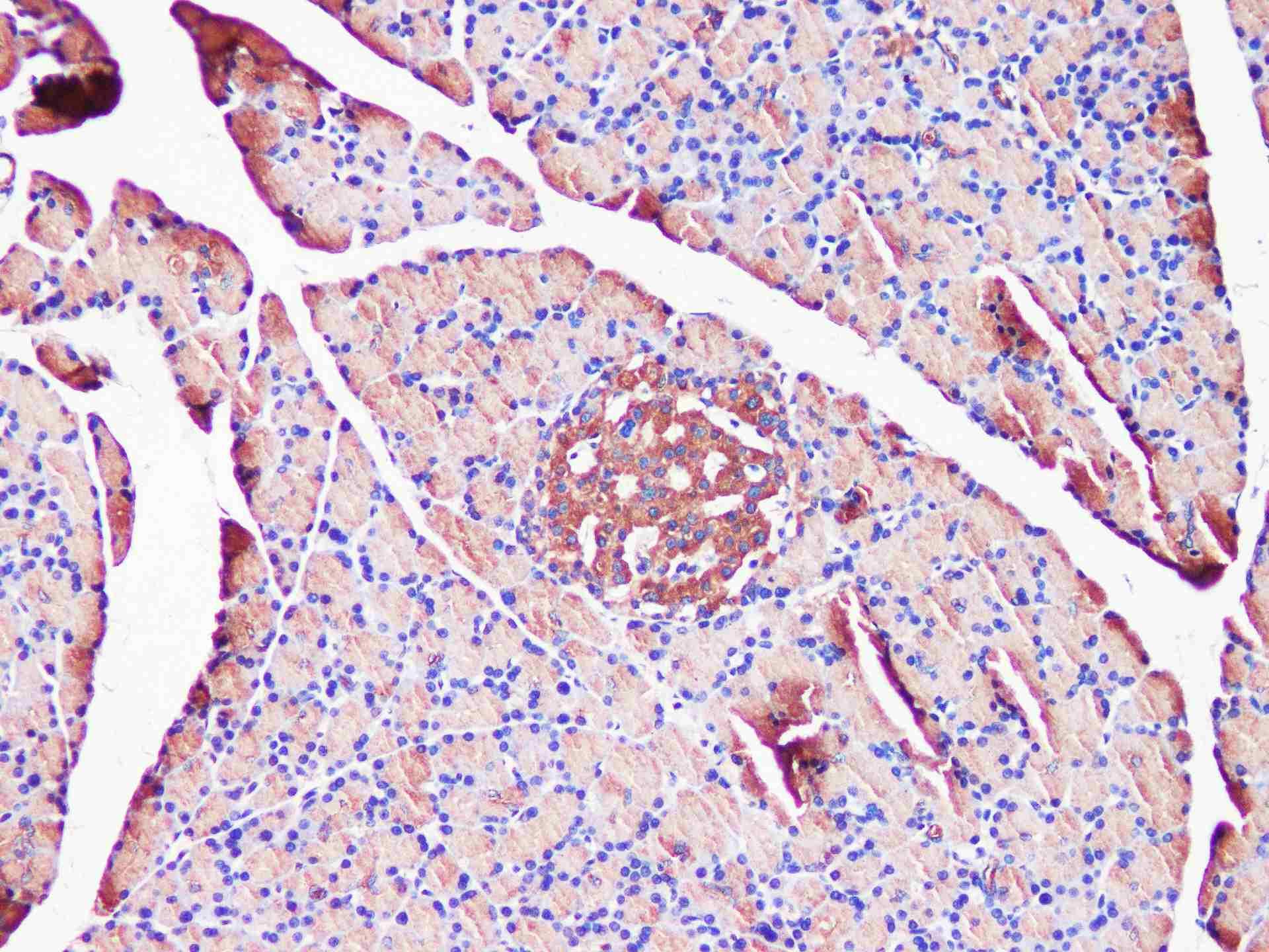 EEF2 Polyclonal Antibody - small - 5