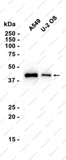 Recombinant TGF beta 1 Monoclonal Antibody - 2