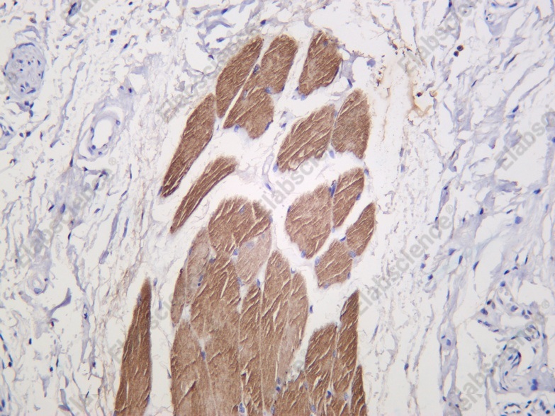 Recombinant Src (Phospho Tyr529) Monoclonal Antibody - 1