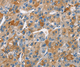 BCL10 Polyclonal Antibody - 3