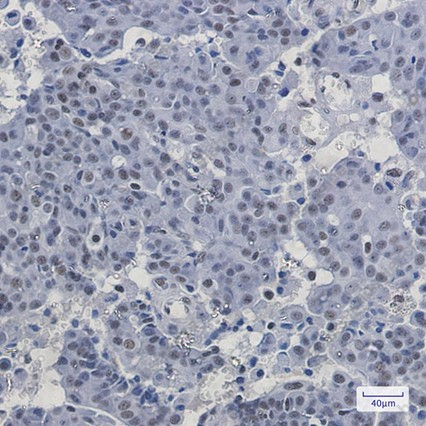 Recombinant PABPN1 Monoclonal Antibody - 2