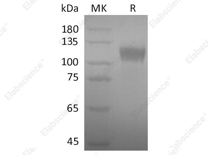 Recombinant SARS-CoV-2 S1 Protein - 1