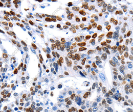 MUTYH Polyclonal Antibody - 3