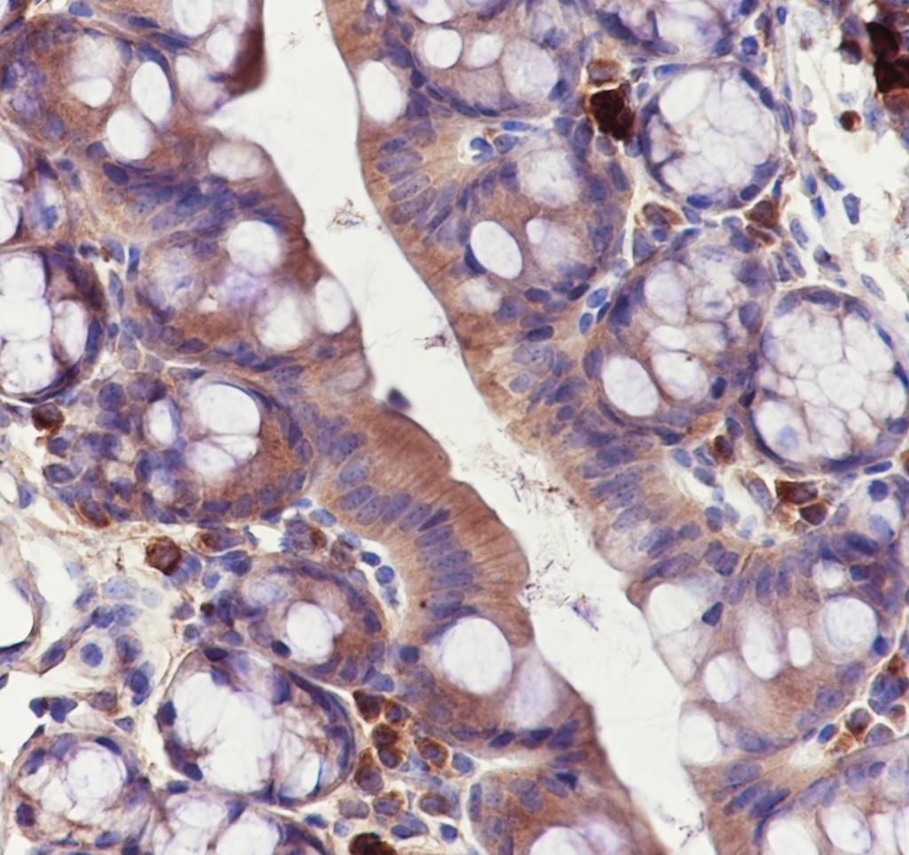 Recombinant APAF1 Monoclonal Antibody - small - 3