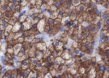 Recombinant Scavenging Receptor SR-BI Monoclonal Antibody-searchlist-2