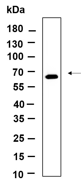 Recombinant Phospho-PERK (Thr980) Monoclonal Antibody-searchlist-1