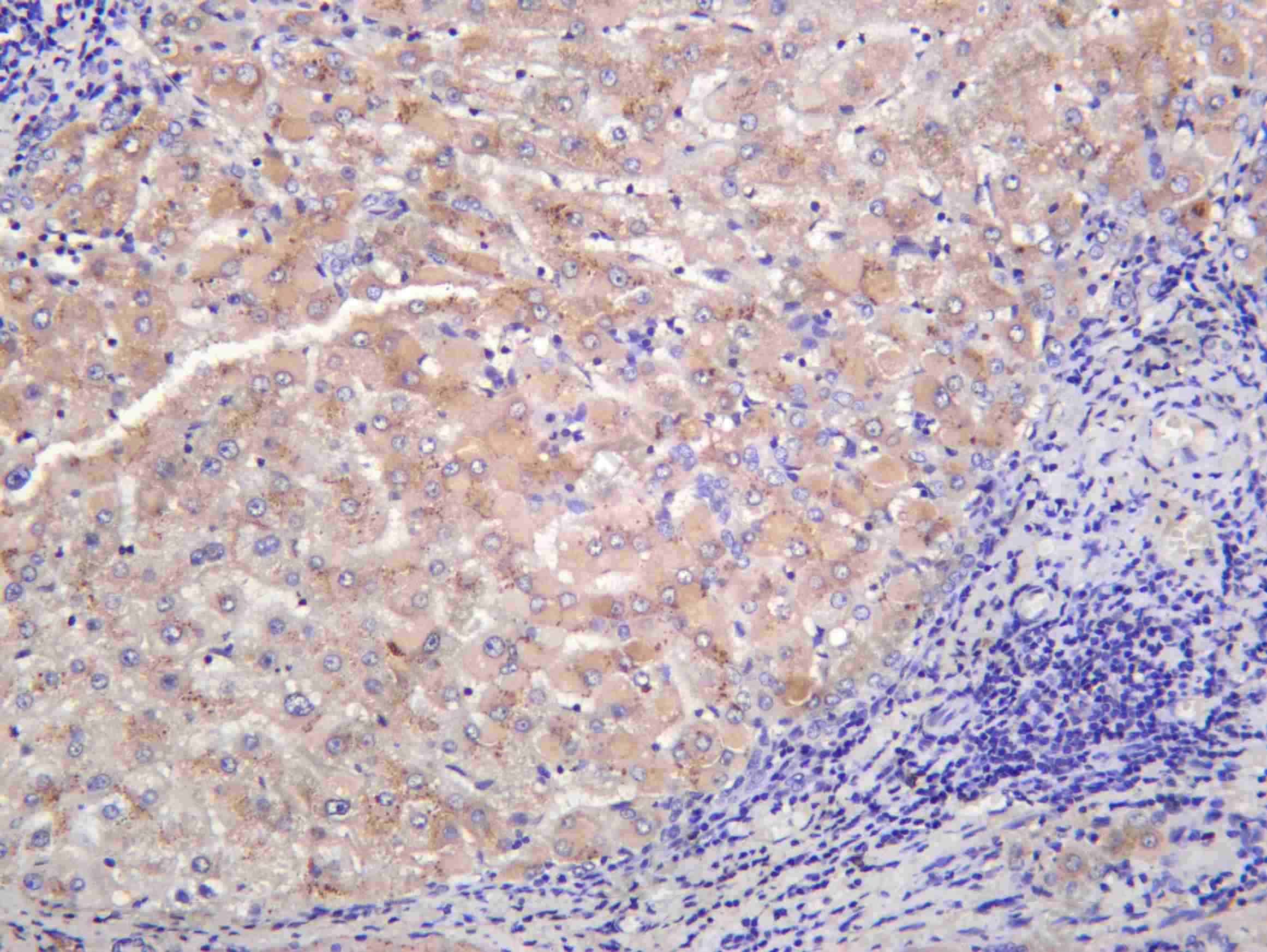 Recombinant Hepassocin Monoclonal Antibody - 1