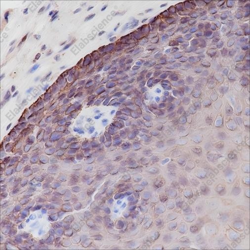 Recombinant Keratin 6 Monoclonal Antibody - 3