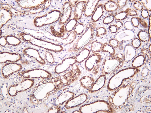 Recombinant CPT2 Monoclonal Antibody - 1