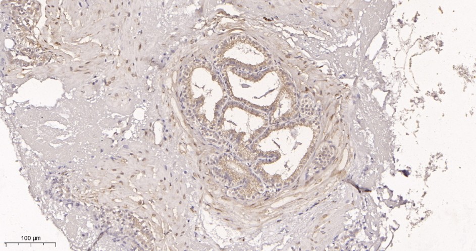 Recombinant LC3A Monoclonal Antibody - small - 3