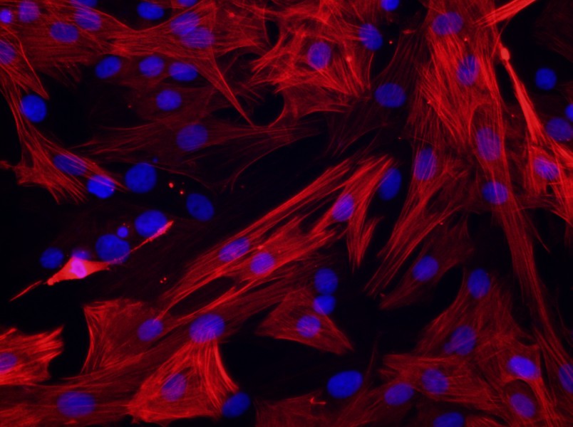 Rat Pulmonary Great Artery Smooth Muscle Cell Complete Medium - small - 4